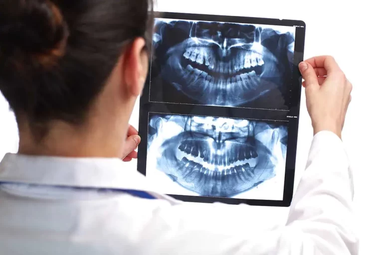 dental x rays